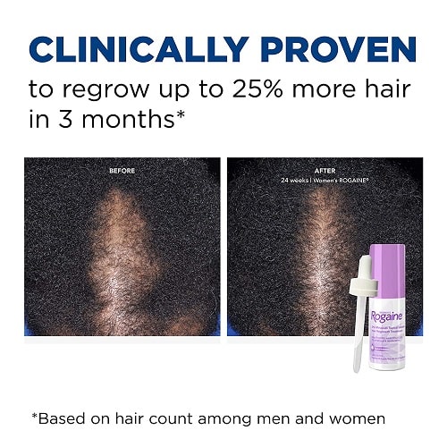 Women's ROGAINE 2% Minoxidil Solution Hair Loss Three month supply