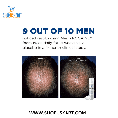 Rogaine Foam India Minoxidil 5% Hair Regrowth Treatment for men 1 Month supply