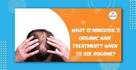 What is Minoxidil's organic hair treatment? When to use Rogaine?