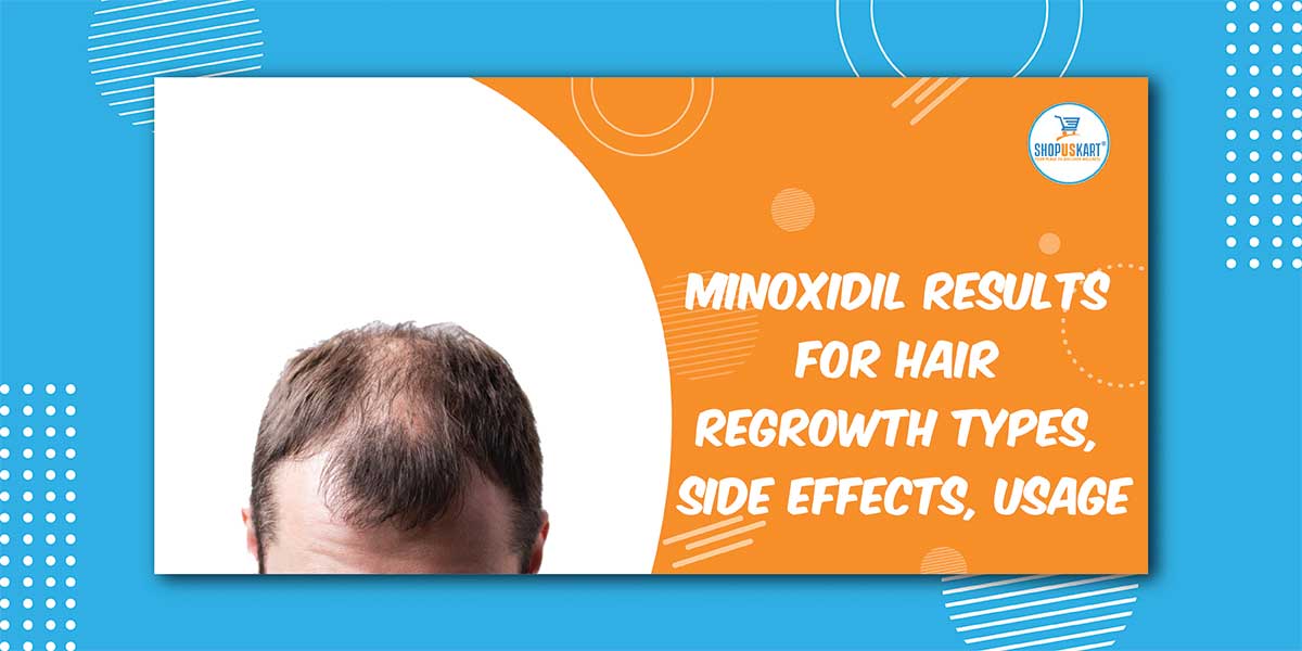 Minoxidil Results for Hair Regrowth Types, side effects, usage