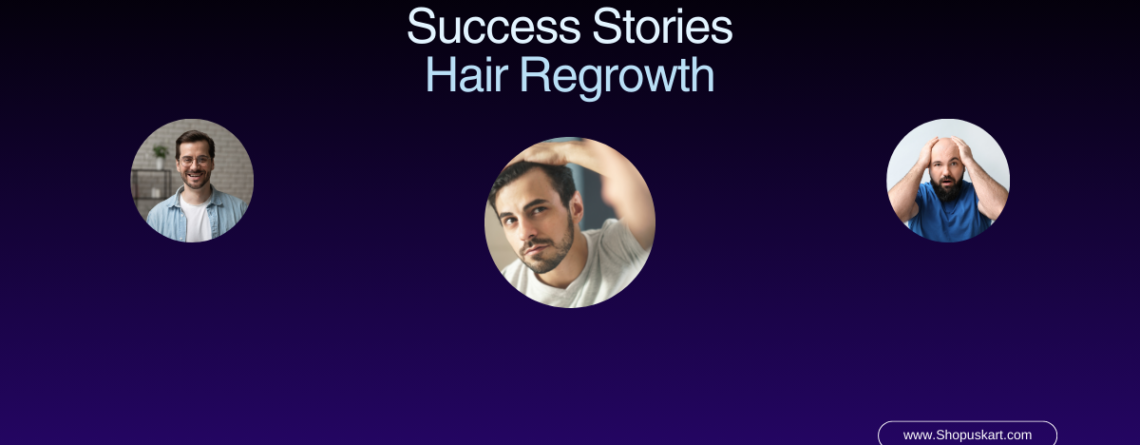 Real-Life Results of Using Hair Regrowth