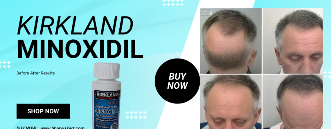 Kirkland Minoxidil Before After Results