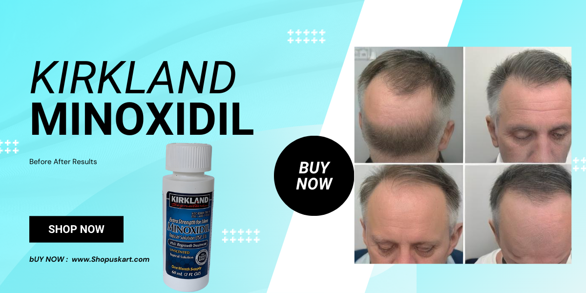 Kirkland Minoxidil Before After Results